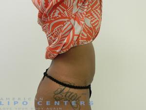 americanlipocenters_921.jpg